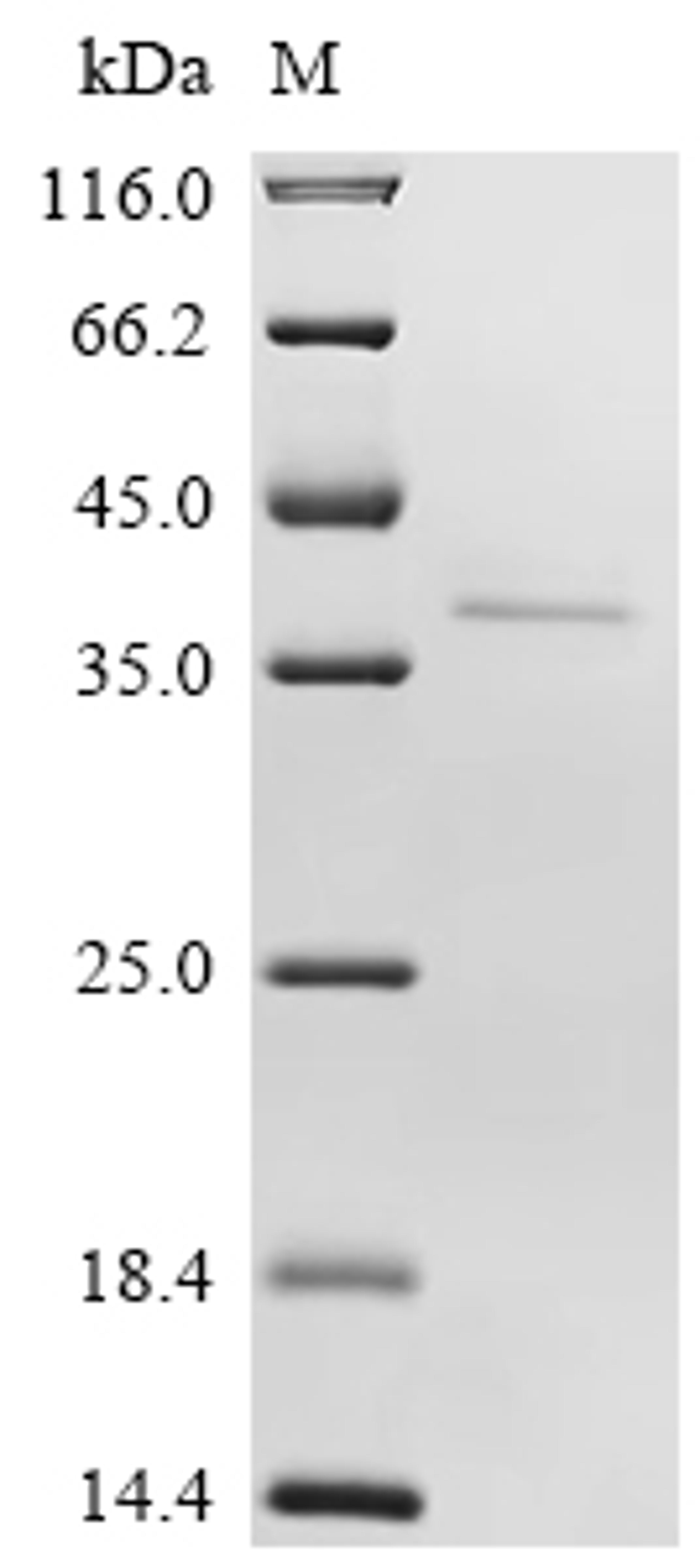 (Tris-Glycine gel) Discontinuous SDS-PAGE (reduced) with 5% enrichment gel and 15% separation gel.