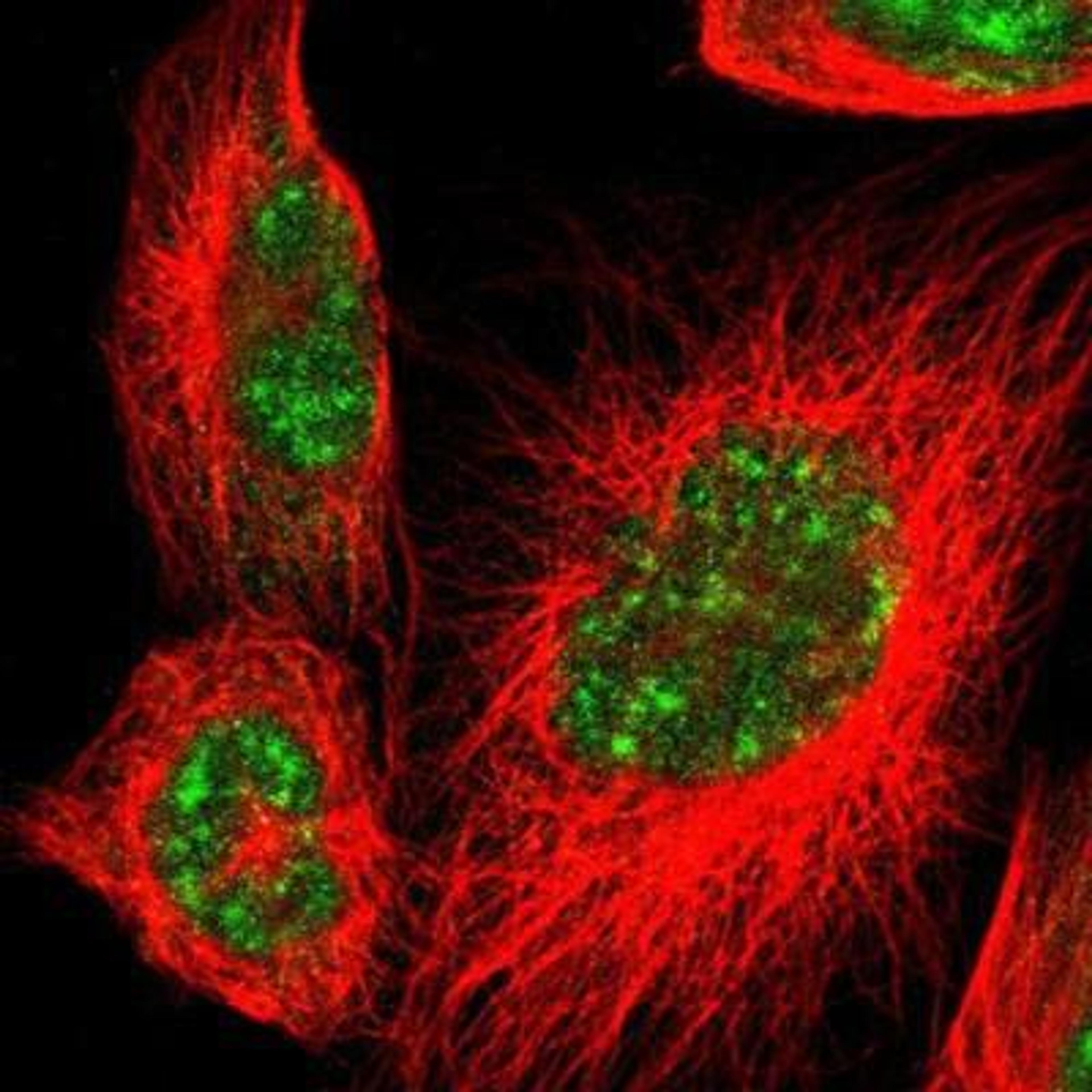 Immunocytochemistry/Immunofluorescence: Msx2/Hox8 Antibody [NBP1-85445] - Staining of human cell line U-251MG shows positivity in nucleus.