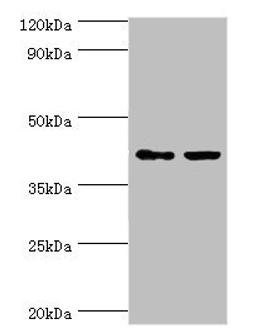 Western blot. All lanes: GTF2H2C antibody at 8ug/ml. Lane 1: HepG2 whole cell lysate. Lane 2: K562 whole cell lysate. Secondary. Goat polyclonal to rabbit IgG at 1/10000 dilution. Predicted band size: 44 kDa. Observed band size: 44 kDa. 