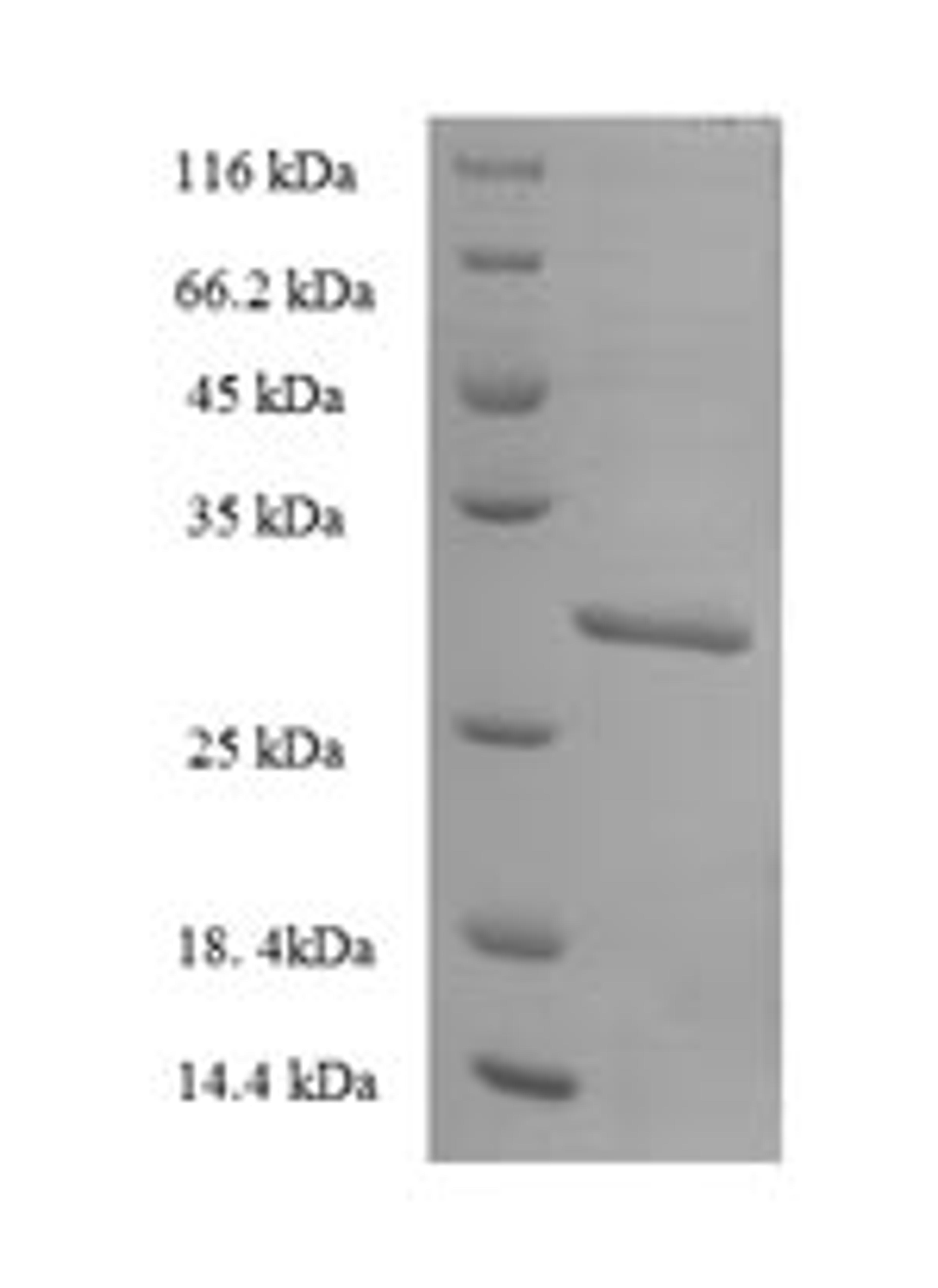 (Tris-Glycine gel) Discontinuous SDS-PAGE (reduced) with 5% enrichment gel and 15% separation gel.
