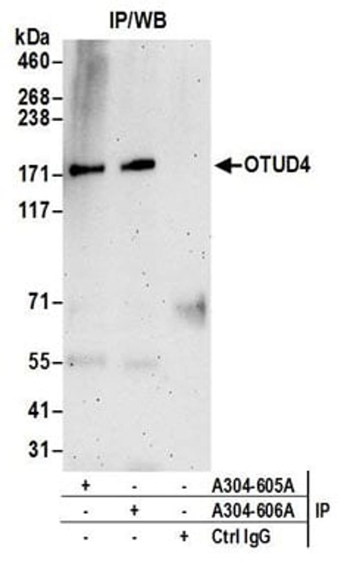 Detection of human OTUD4 by western blot of immunoprecipitates.