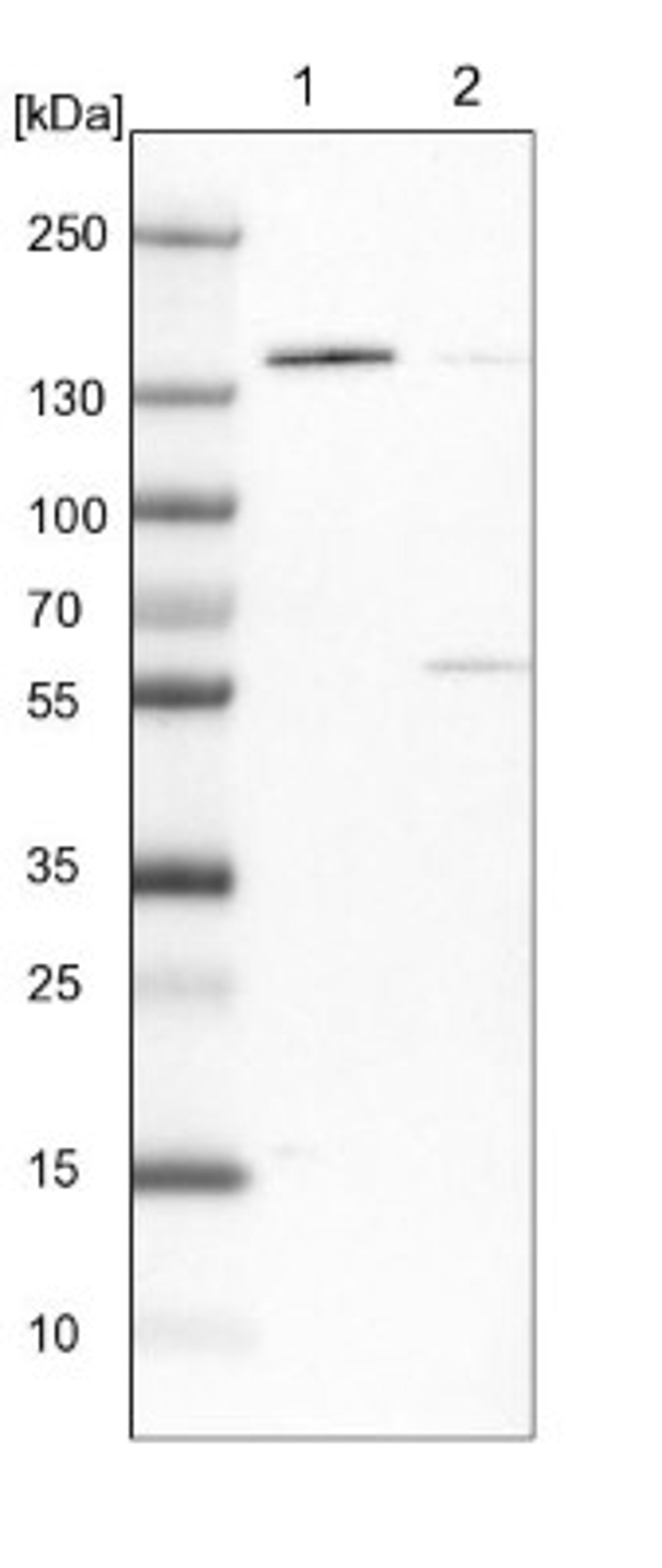 Western Blot: DPPII/QPP/DPP7 Antibody [NBP1-84986] - Lane 1: NIH-3T3 cell lysate (Mouse embryonic fibroblast cells)<br/>Lane 2: NBT-II cell lysate (Rat Wistar bladder tumour cells)