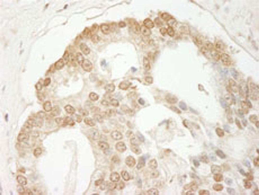 Detection of human C1orf55 immunohistochemistry.