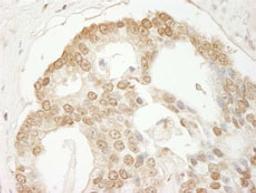 Detection of human C1orf55 immunohistochemistry.