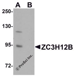 Western blot analysis of ZC3H12B in mouse brain tissue lysate with ZC3H12B antibody at 1 μg/mL in (A) the absence and (B) the presence of blocking peptide.