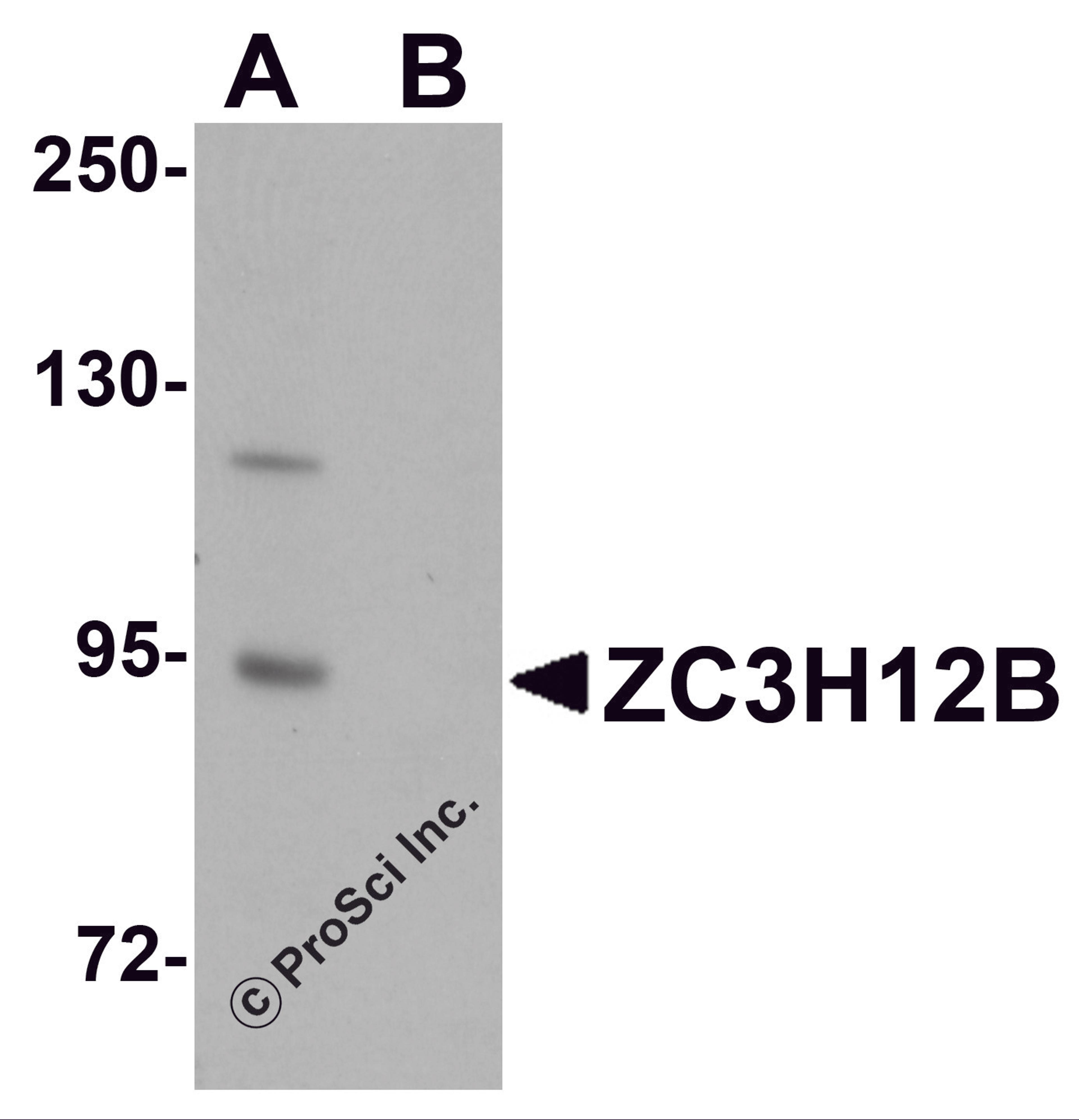 Western blot analysis of ZC3H12B in mouse brain tissue lysate with ZC3H12B antibody at 1 μg/mL in (A) the absence and (B) the presence of blocking peptide.