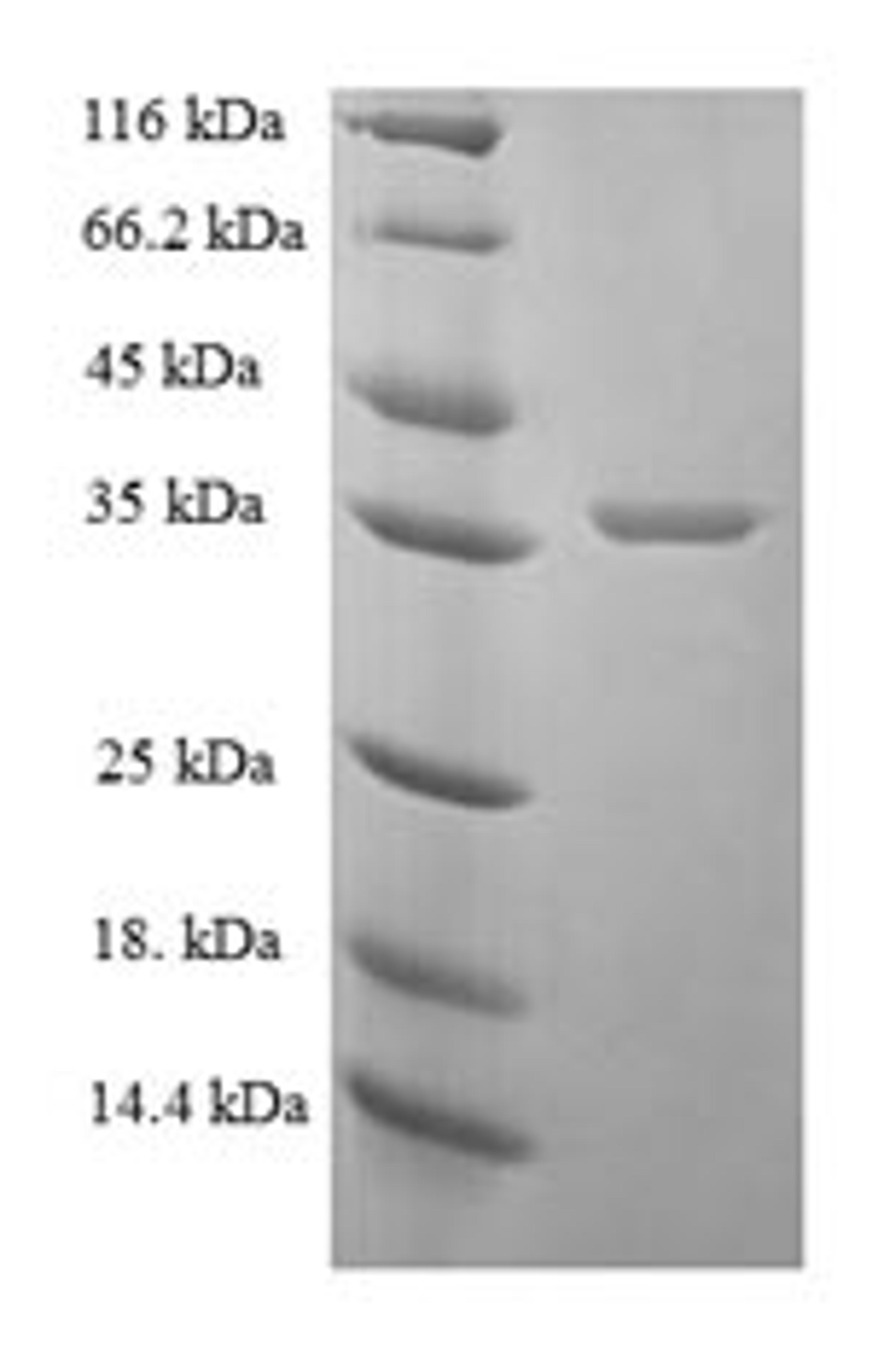 (Tris-Glycine gel) Discontinuous SDS-PAGE (reduced) with 5% enrichment gel and 15% separation gel.