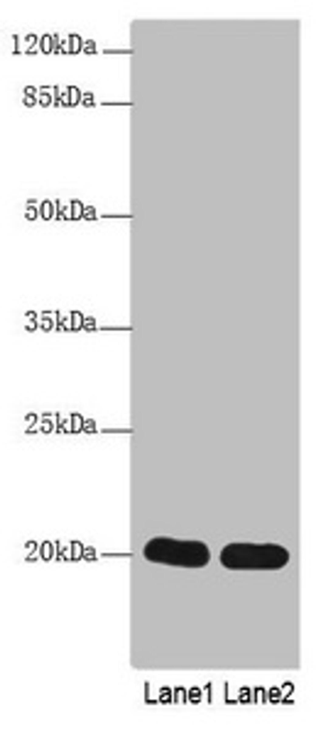 Western Blot. All lanes: CABP5 antibody at 12µg/ml. Lane 1: Mouse kidney tissue. Lane 2: Mouse thymus tissue. Secondary. Goat polyclonal to rabbit IgG at 1/10000 dilution. Predicted band size: 20 kDa. Observed band size: 20 kDa