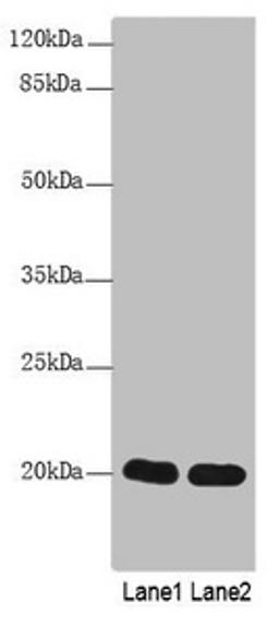 Western Blot. All lanes: CABP5 antibody at 12µg/ml. Lane 1: Mouse kidney tissue. Lane 2: Mouse thymus tissue. Secondary. Goat polyclonal to rabbit IgG at 1/10000 dilution. Predicted band size: 20 kDa. Observed band size: 20 kDa