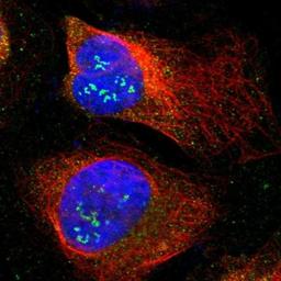 Immunocytochemistry/Immunofluorescence: BTN3A3 Antibody [NBP1-88509] - Staining of human cell line U-2 OS shows positivity in nucleoli & cytoplasm.