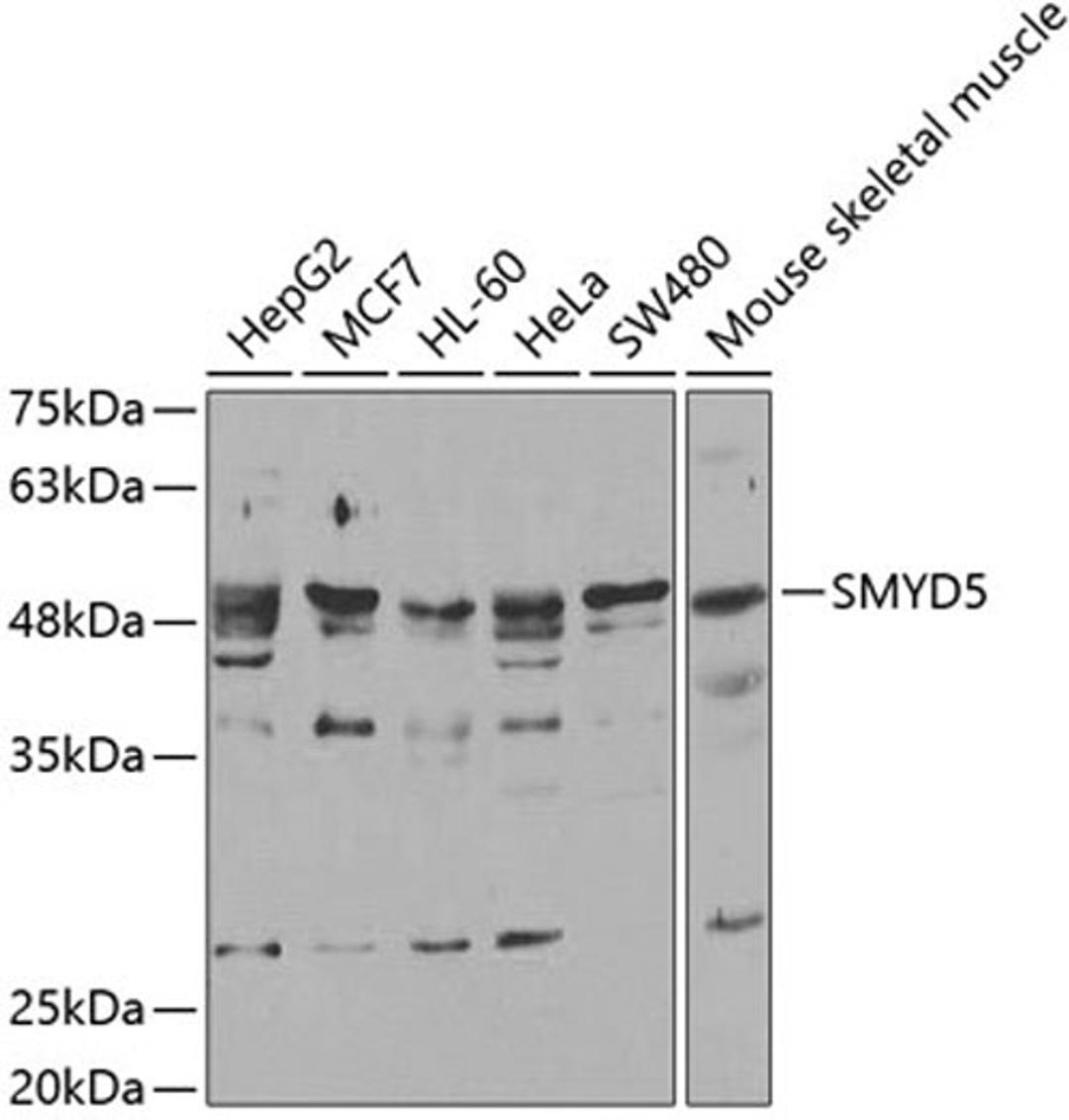 Western blot - SMYD5 antibody (A6191)