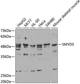 Western blot - SMYD5 antibody (A6191)