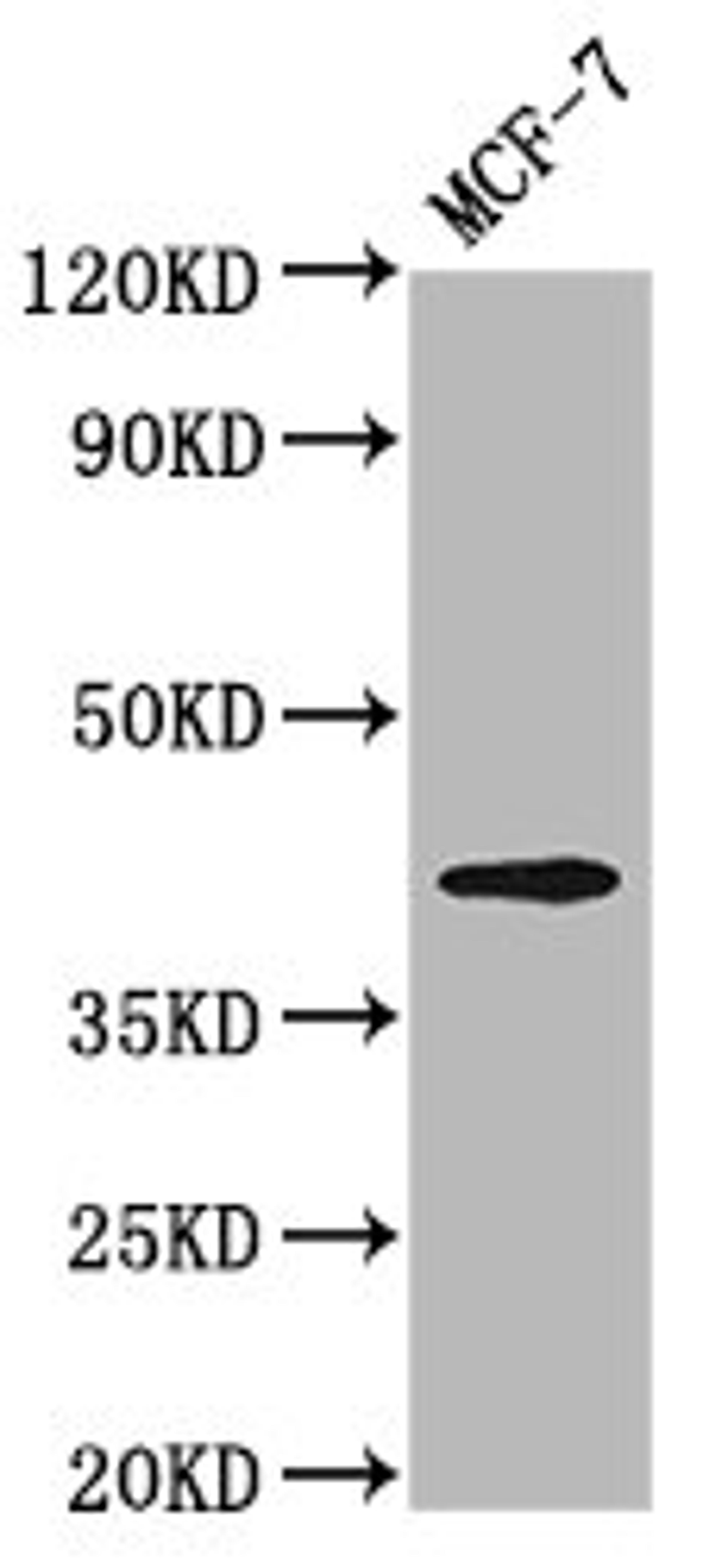Western Blot. Positive WB detected in: MCF-7 whole cell lysate. All lanes: OPN1MW antibody at 3.2µg/ml. Secondary. Goat polyclonal to rabbit IgG at 1/50000 dilution. Predicted band size: 41 kDa. Observed band size: 41 kDa
