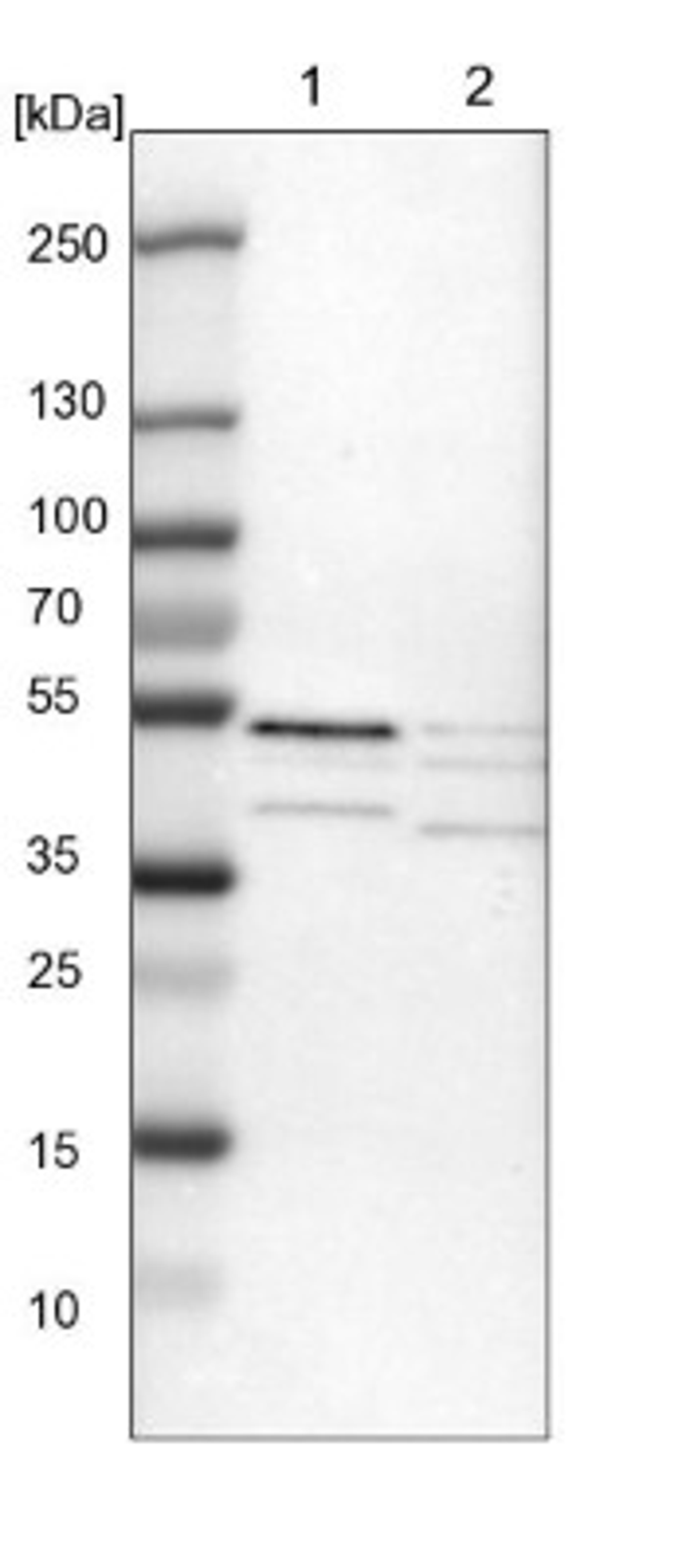 Western Blot: SKAR Antibody [NBP1-92392] - Lane 1: NIH-3T3 cell lysate (Mouse embryonic fibroblast cells)<br/>Lane 2: NBT-II cell lysate (Rat Wistar bladder tumour cells)