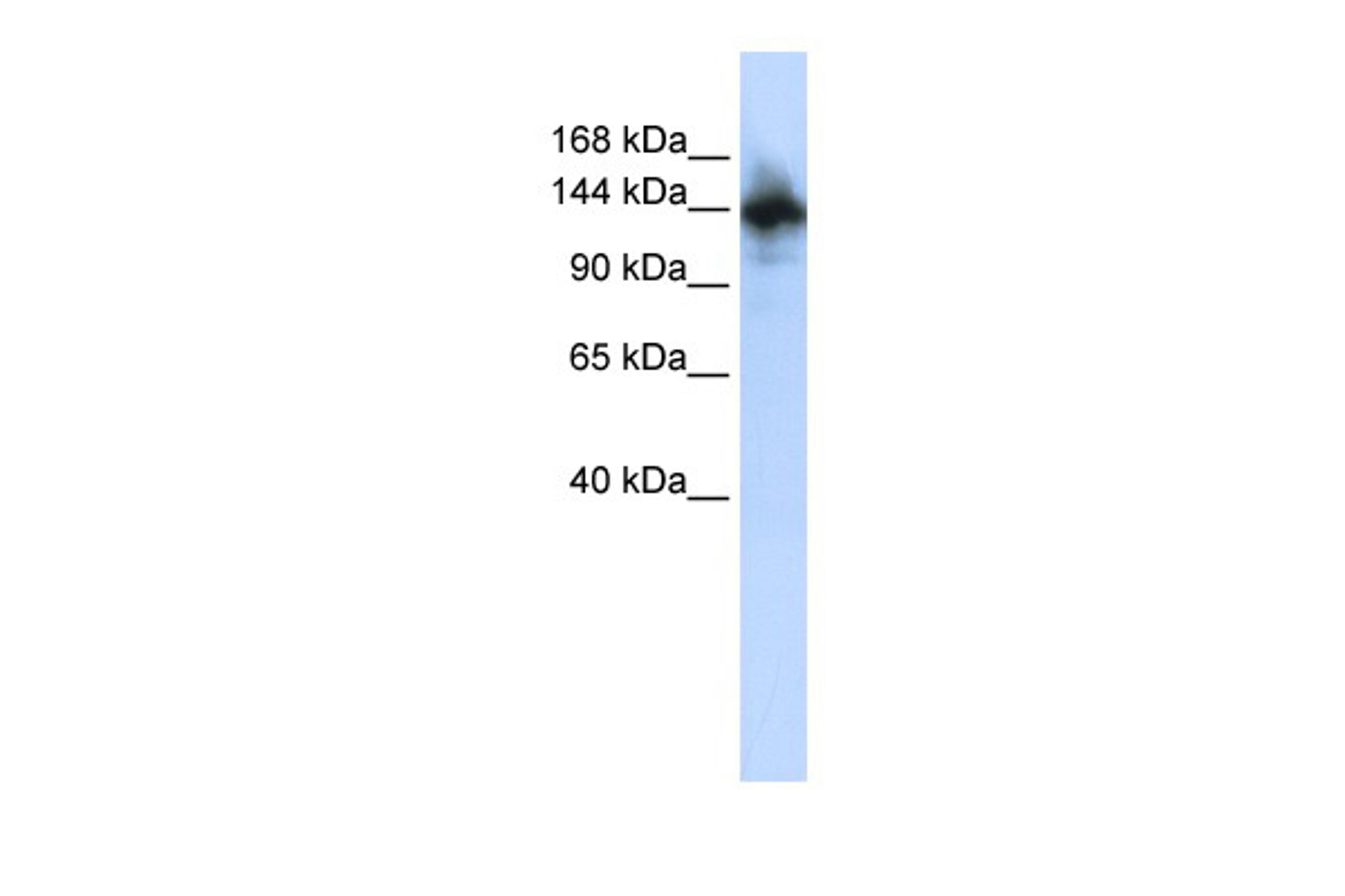 Antibody used in WB on Human HepG2 at 0.2-1 ug/ml.