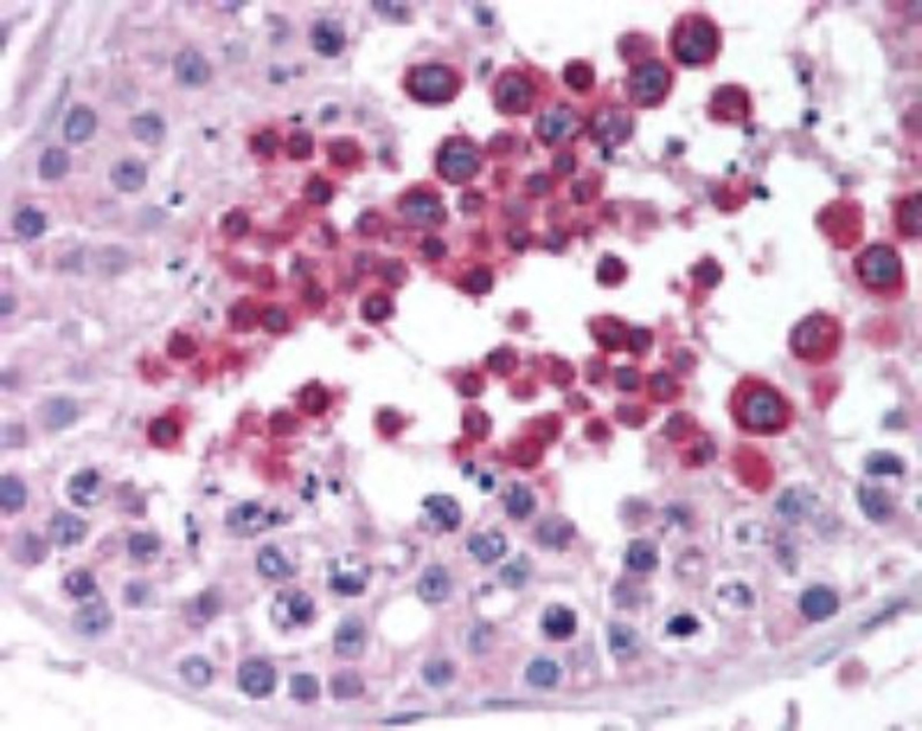 Immunohistochemistry-Paraffin: NPY2R Antibody [NB100-56480] - Analysis of human testis using this antibody at 10 ug/ml.