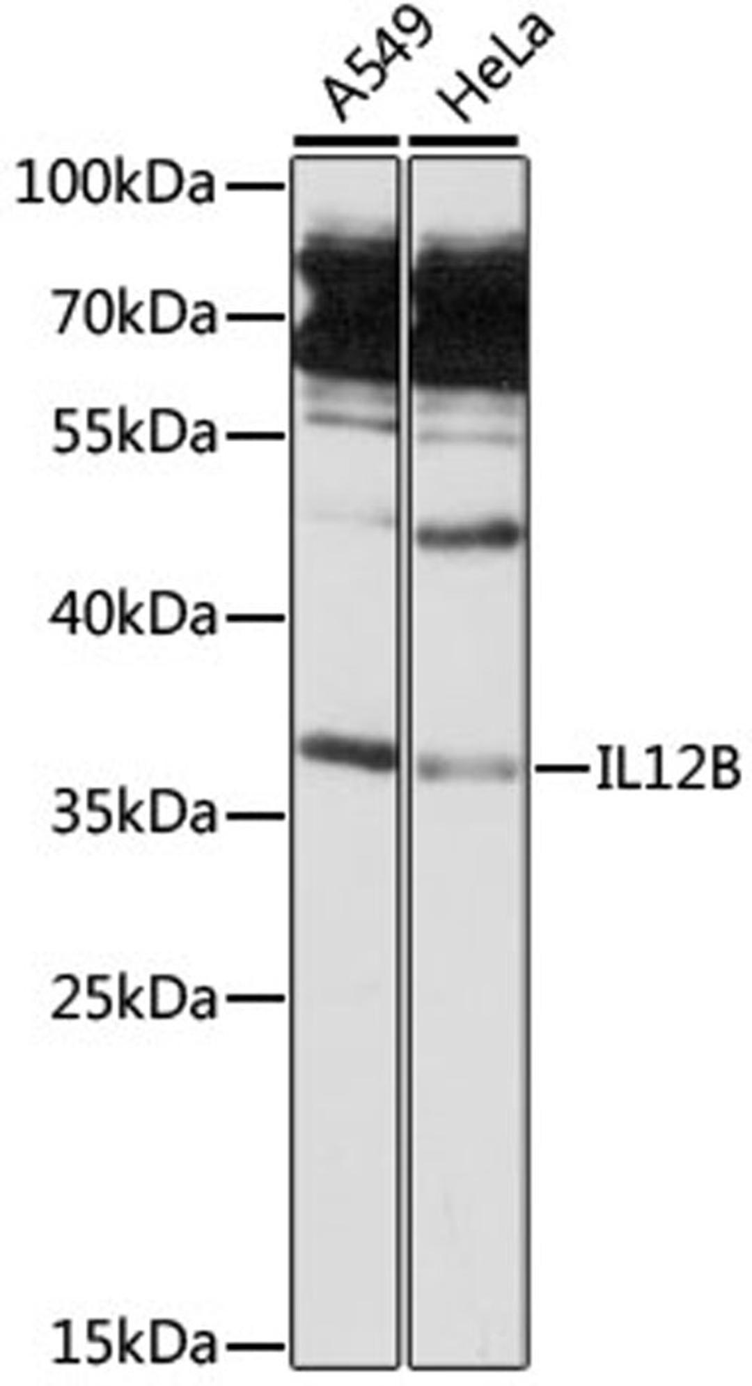 Western blot - IL12B antibody (A13024)