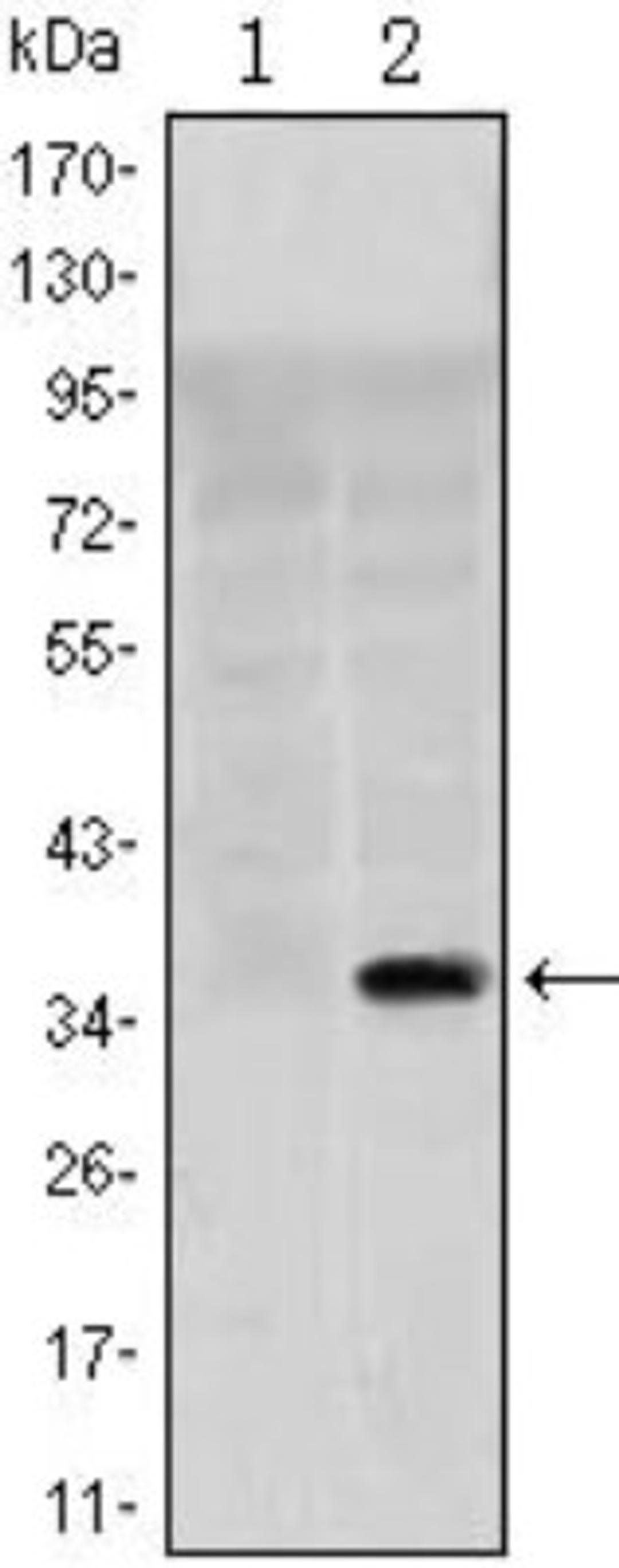 Western Blot: SLC22A1 Antibody (2C5) [NBP1-51684] - Analysis using SLC22A1 mAb against HEK293 (1) and SLC22A1(AA: 284-347)-hIgGFc transfected HEK293 (2) cell lysate.