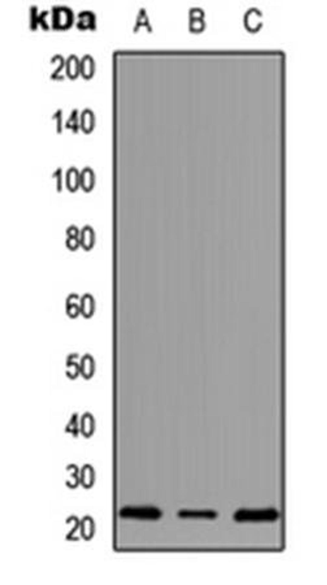 Western blot analysis of HEK293T (Lane1), Raw264.7 (Lane2), H9C2 (Lane3) whole cell using MRPS18A antibody