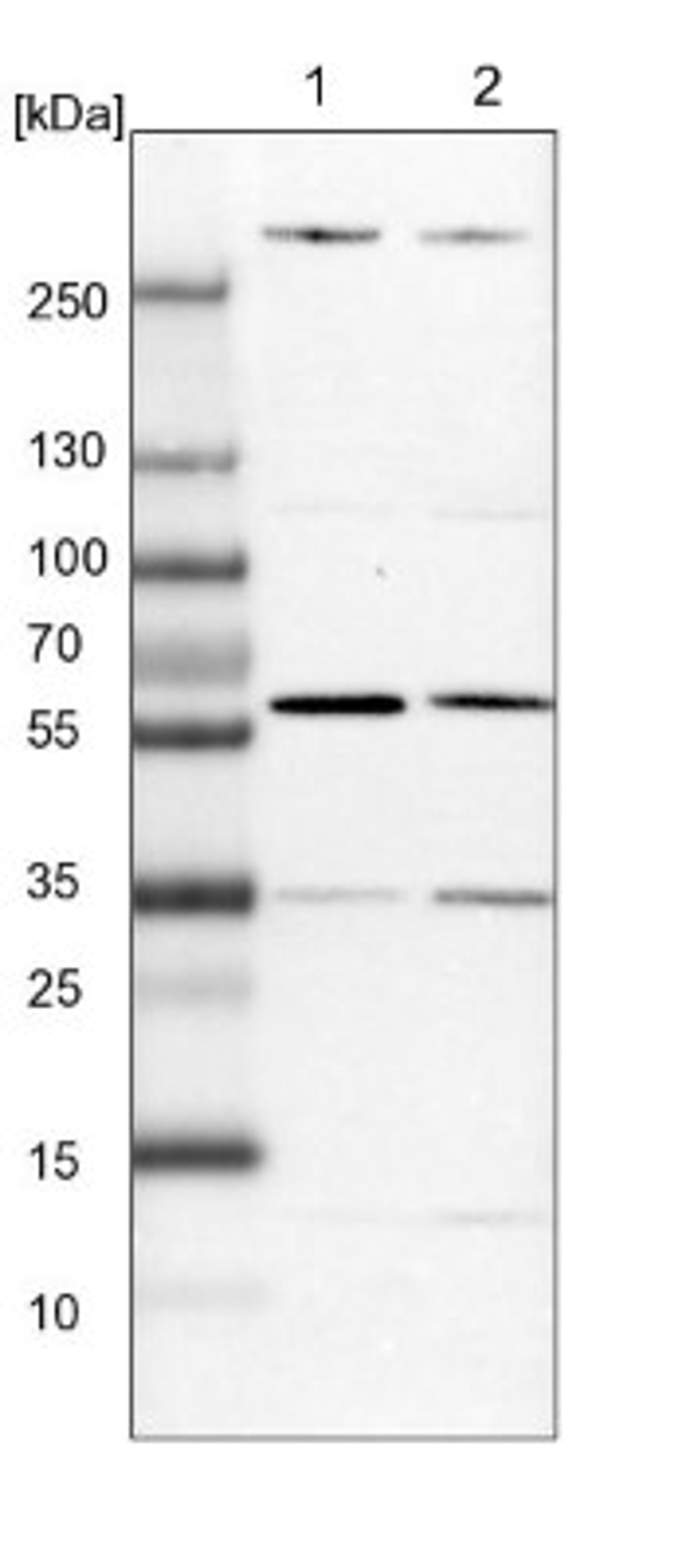 Western Blot: MMP21 Antibody [NBP1-85980] - Lane 1: NIH-3T3 cell lysate (Mouse embryonic fibroblast cells)<br/>Lane 2: NBT-II cell lysate (Rat Wistar bladder tumour cells)