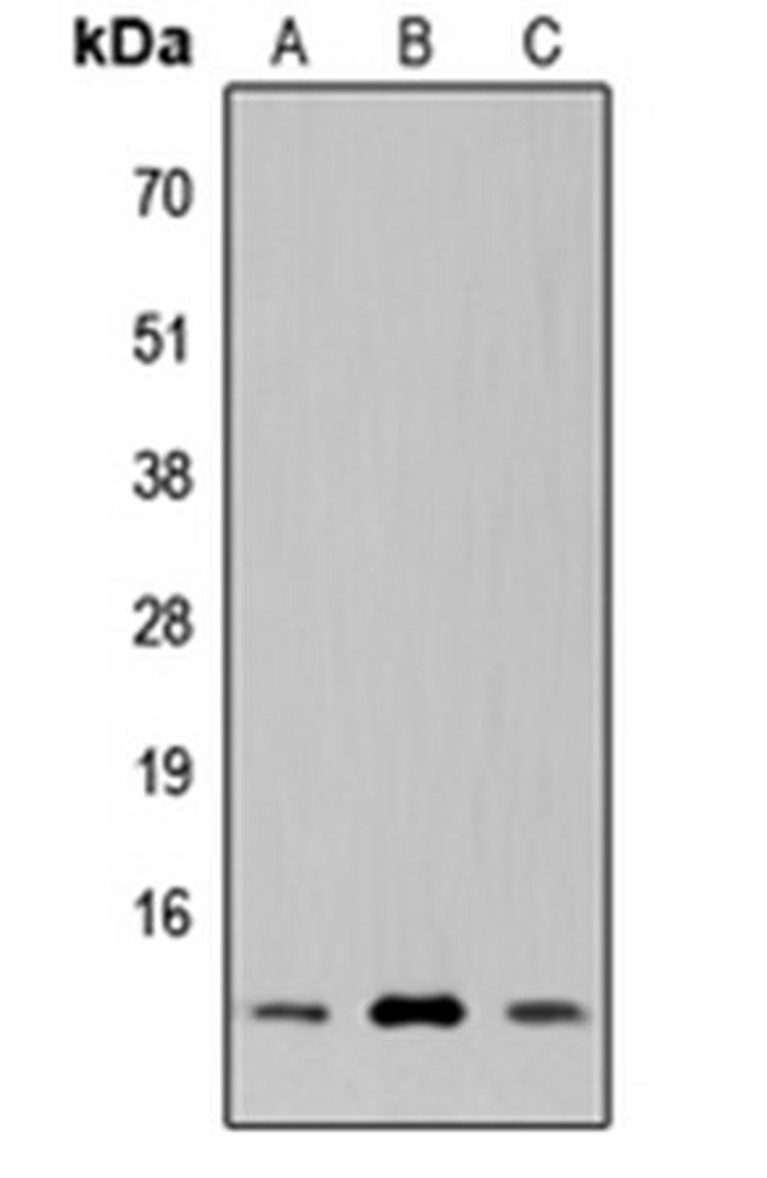 Western blot analysis of HeLa (Lane 1), NS-1 (Lane 2), PC12 (Lane 3) whole cell lysates using SUPT4H antibody