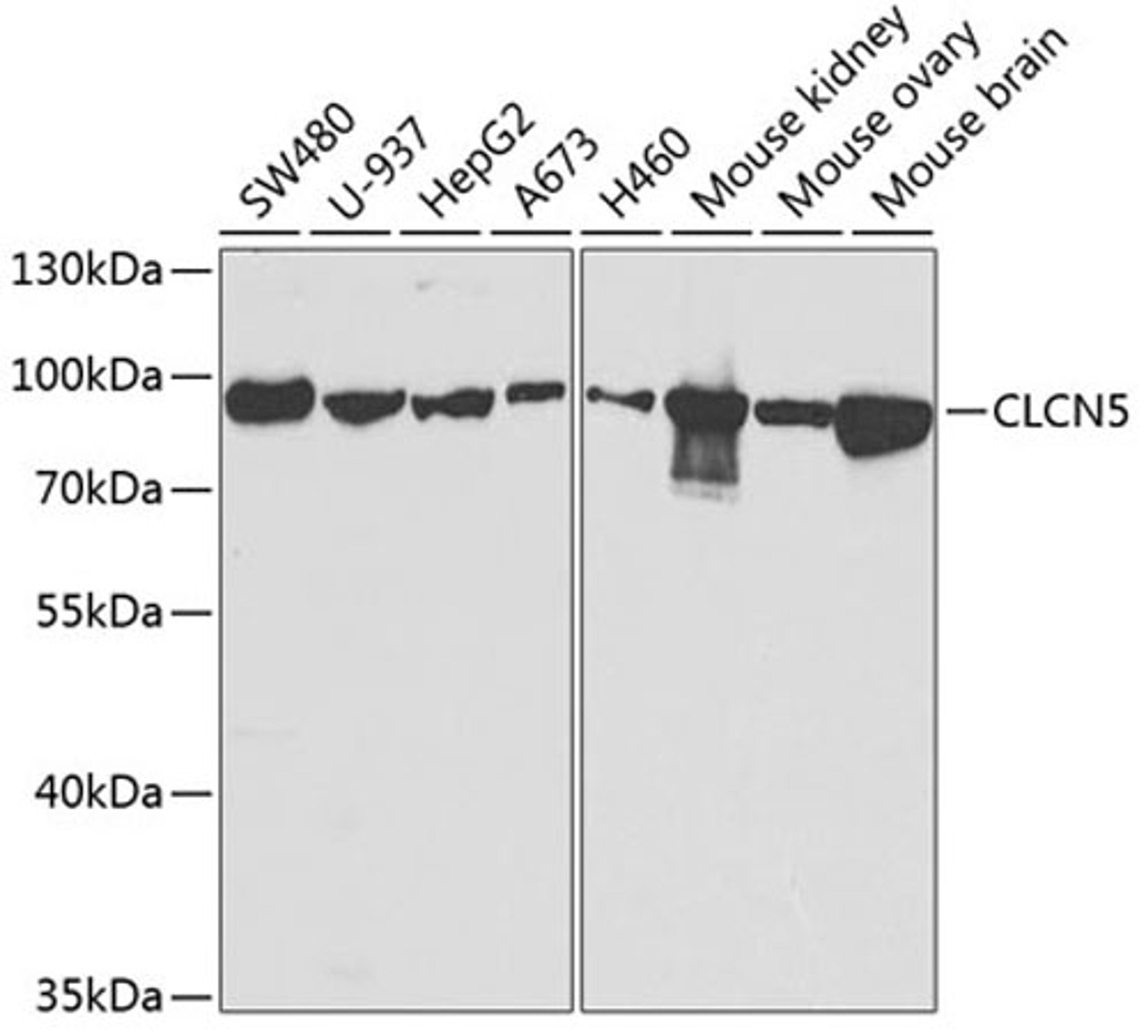 Western blot - CLCN5 antibody (A5707)