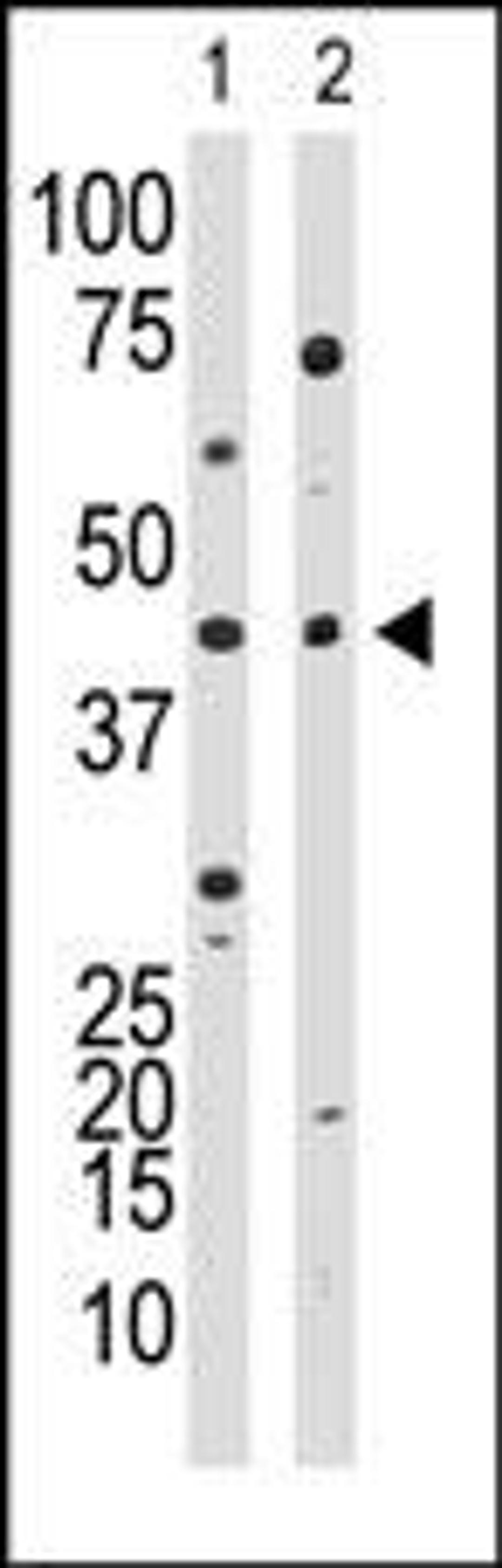 Western blot analysis of anti-YY1 Ctr Pab in HL60 cell lysate (lane 1) and in mouse kidney tissue lysate (lane 2)