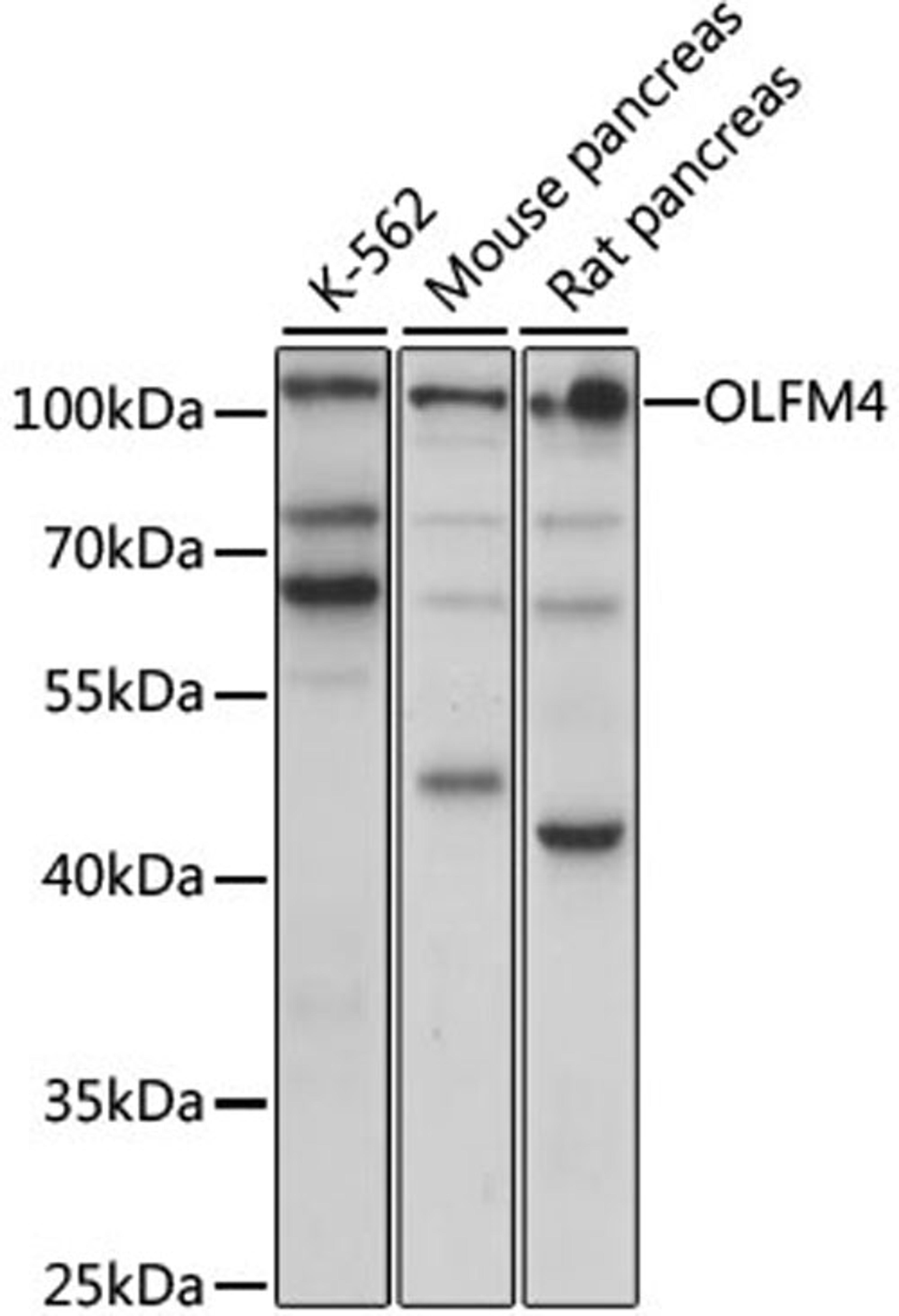 Western blot - OLFM4 antibody (A15387)