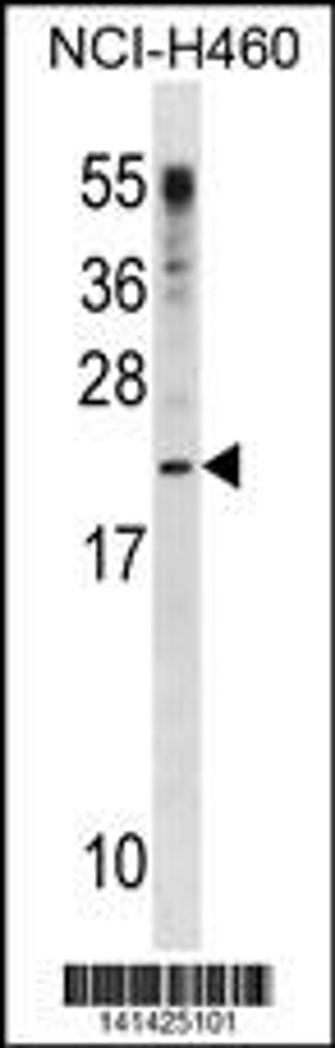 Western blot analysis in NCI-H460 cell line lysates (35ug/lane).