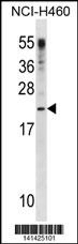 Western blot analysis in NCI-H460 cell line lysates (35ug/lane).