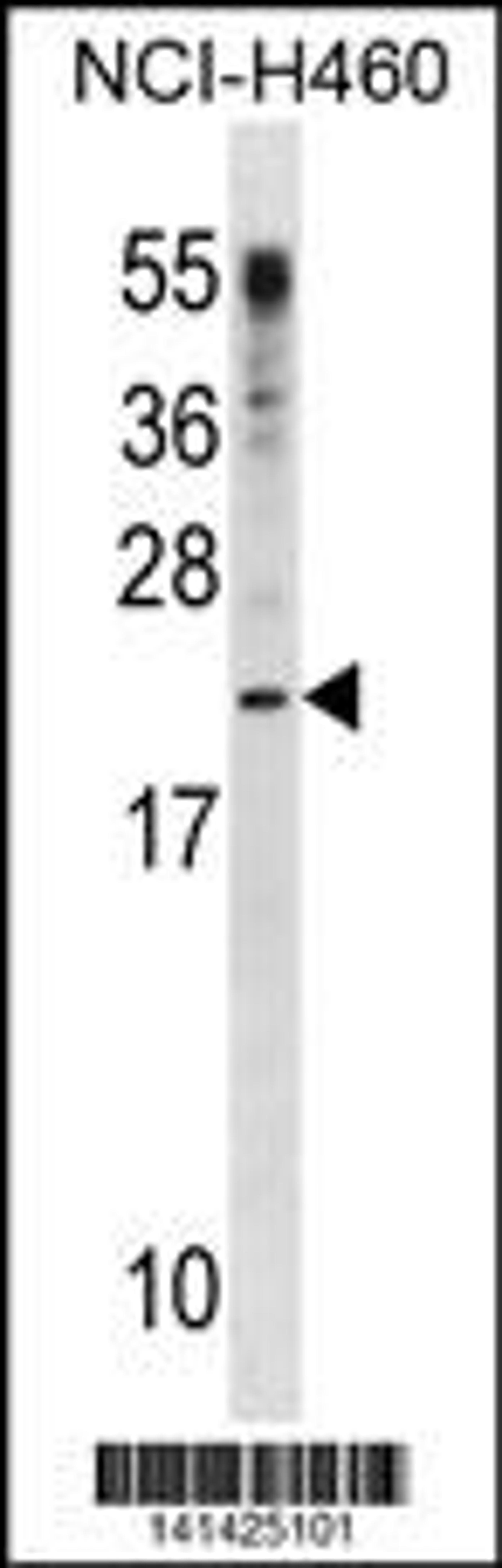 Western blot analysis in NCI-H460 cell line lysates (35ug/lane).