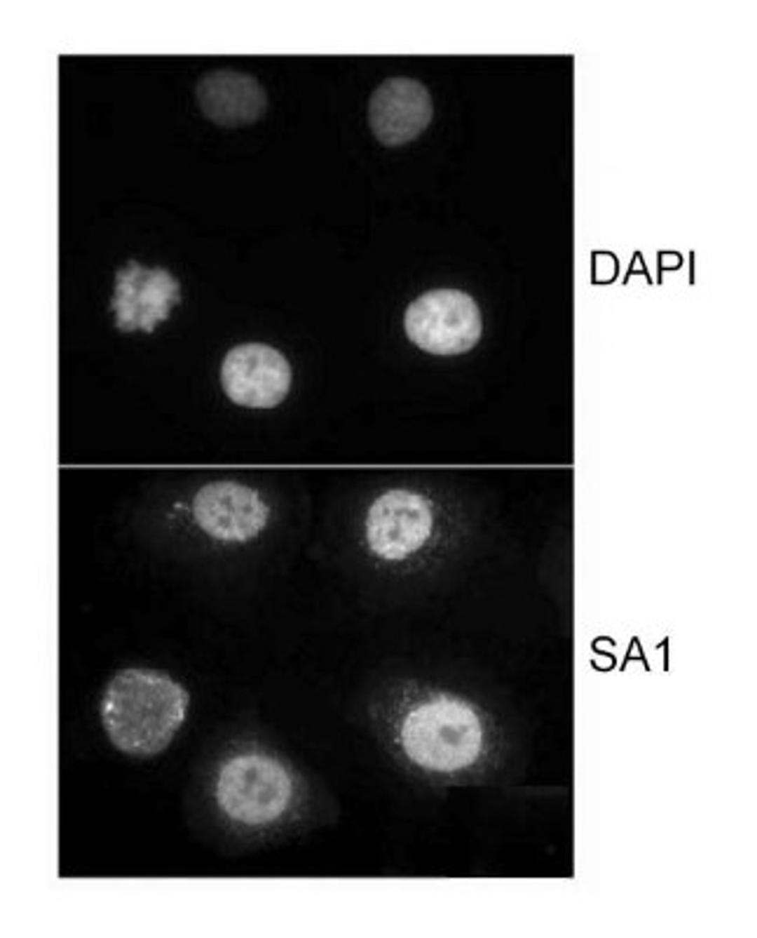 Immunocytochemistry/Immunofluorescence: SA1 Antibody [NB100-298] - HeLa cells that were extracted for 5 min at 4C in 0.5% Triton in CSK buffer.  Antibody used at 1 ug/ml.