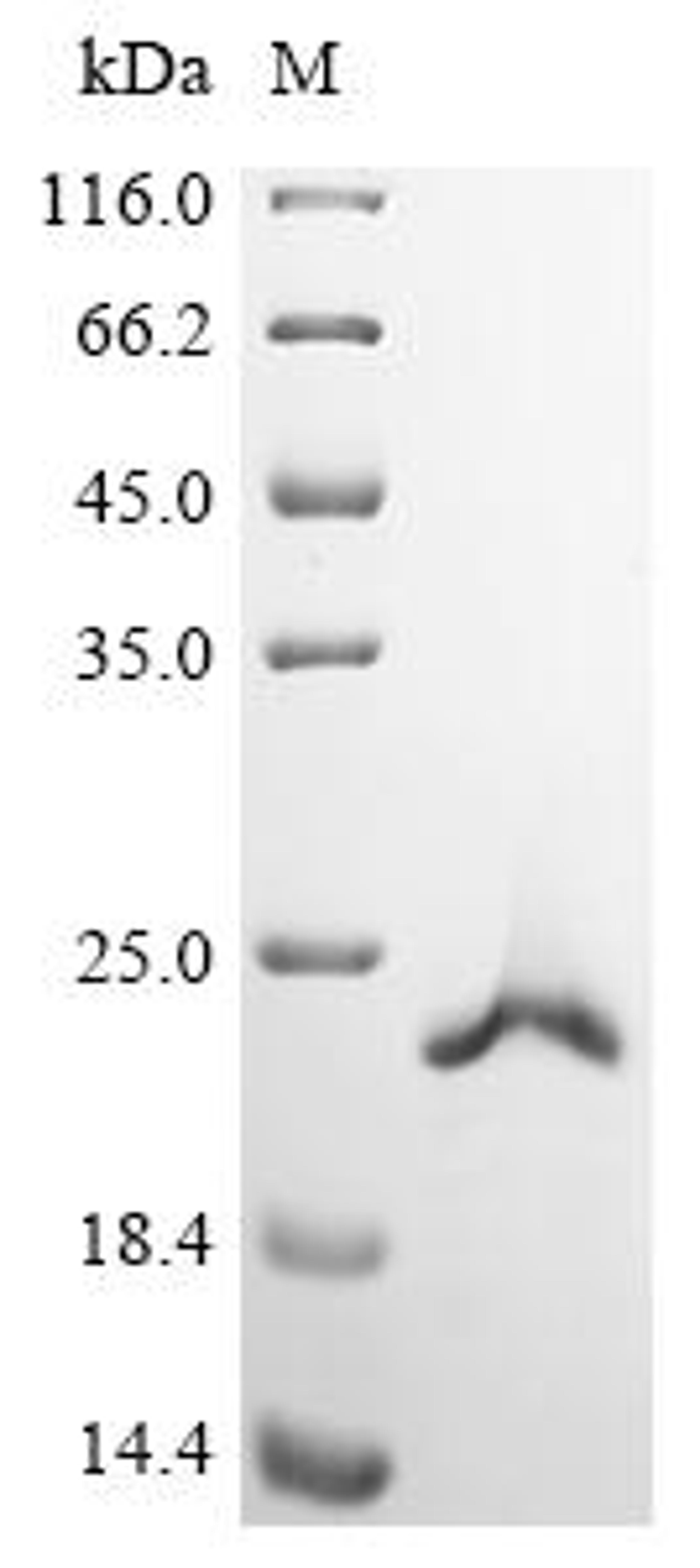 (Tris-Glycine gel) Discontinuous SDS-PAGE (reduced) with 5% enrichment gel and 15% separation gel.
