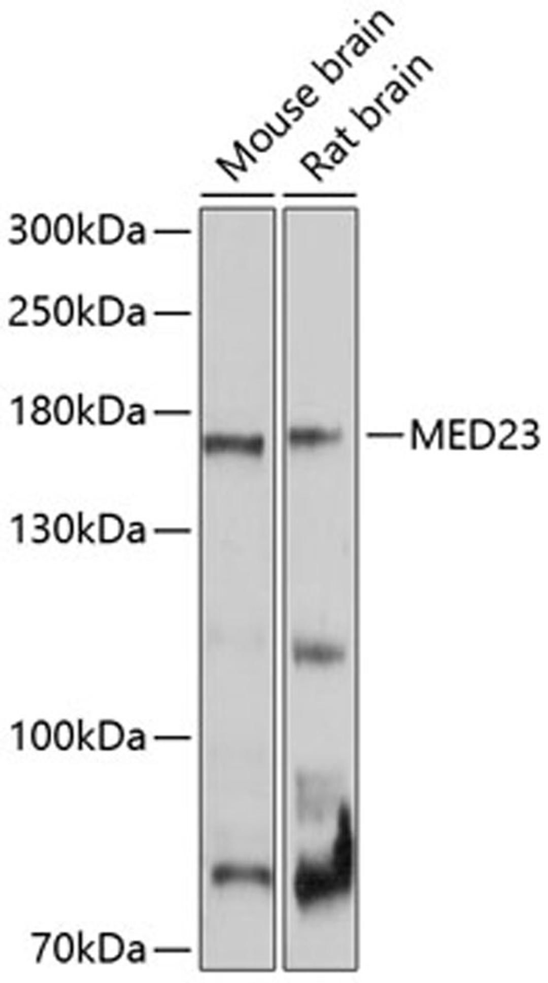 Western blot - MED23 Antibody (A10163)