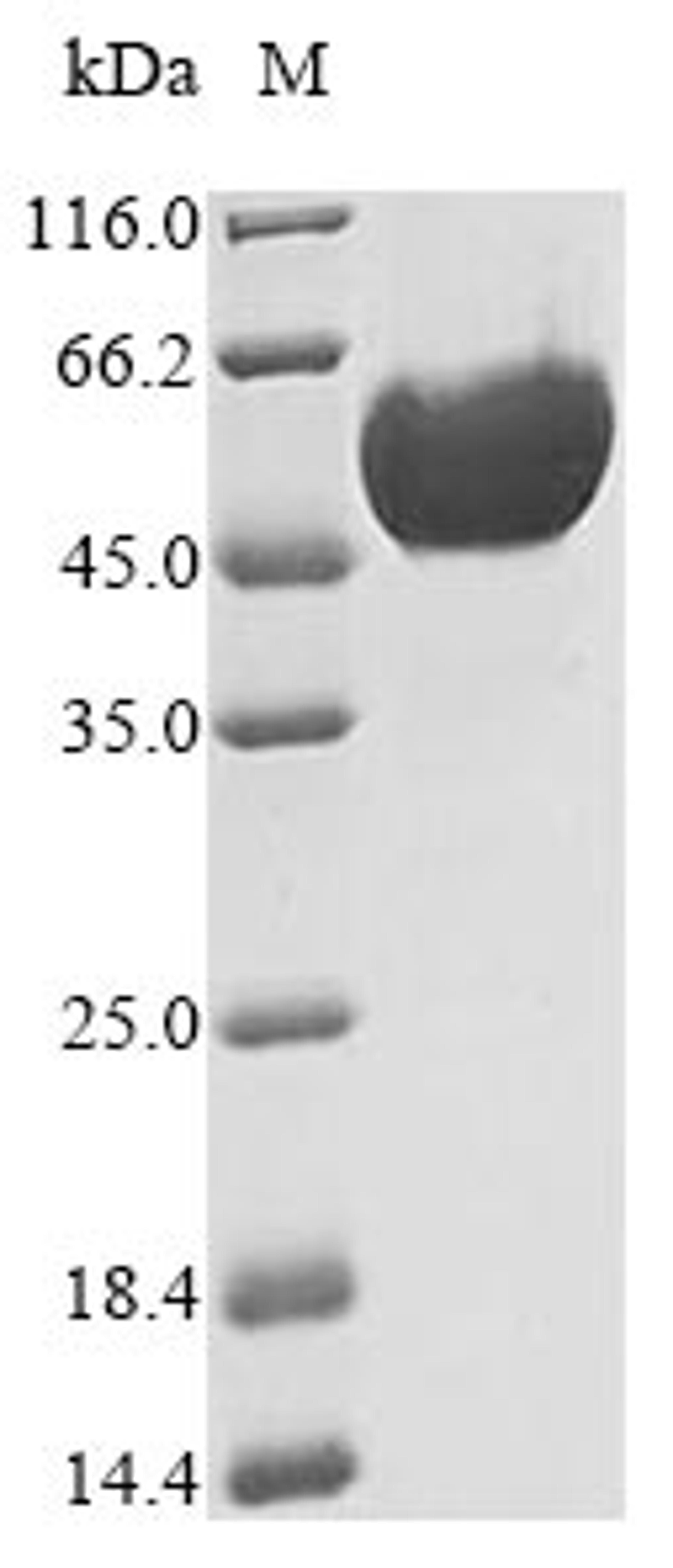 (Tris-Glycine gel) Discontinuous SDS-PAGE (reduced) with 5% enrichment gel and 15% separation gel.