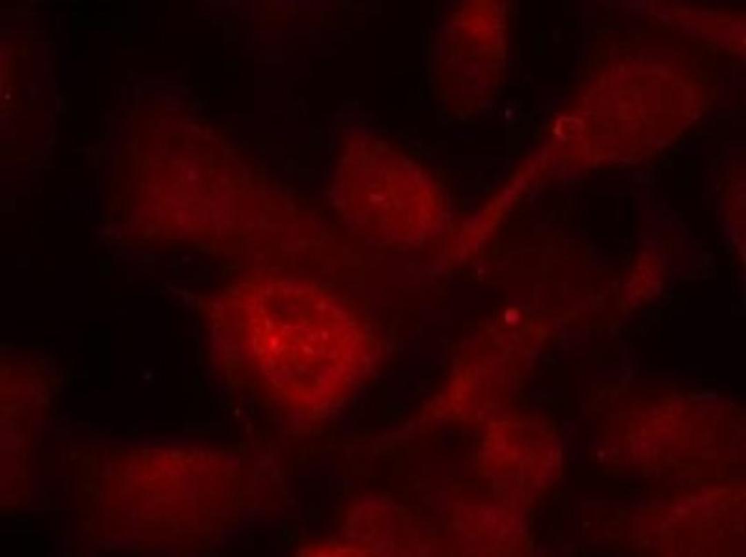 Immunocytochemistry/Immunofluorescence: PAK1/2/3 Antibody [NB100-82130] - Staining of methanol-fixed Hela cells using PAK1/PAK2/PAK3(Ab-423/402/421) antibody