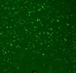 Confocal Immunofluorescence analysis of human hippocampal tissues using HCN3 antibody