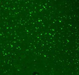 Confocal Immunofluorescence analysis of human hippocampal tissues using HCN3 antibody