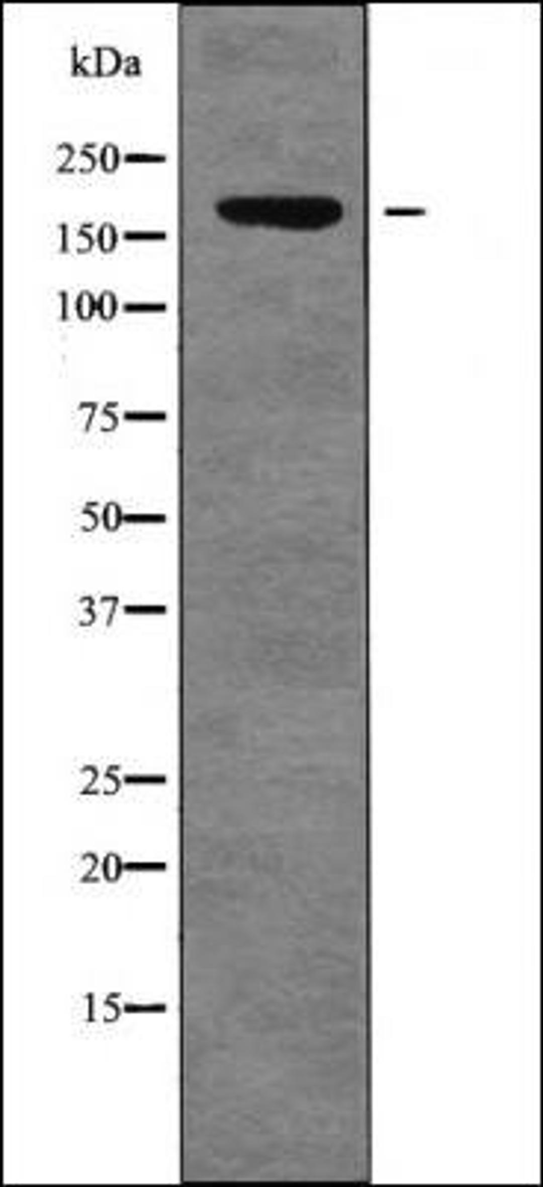 Western blot analysis of Mouse braintissue lysates using FANCD2 -Phospho-Thr691- antibody