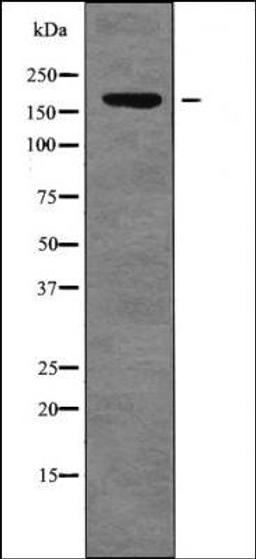 Western blot analysis of Mouse braintissue lysates using FANCD2 -Phospho-Thr691- antibody