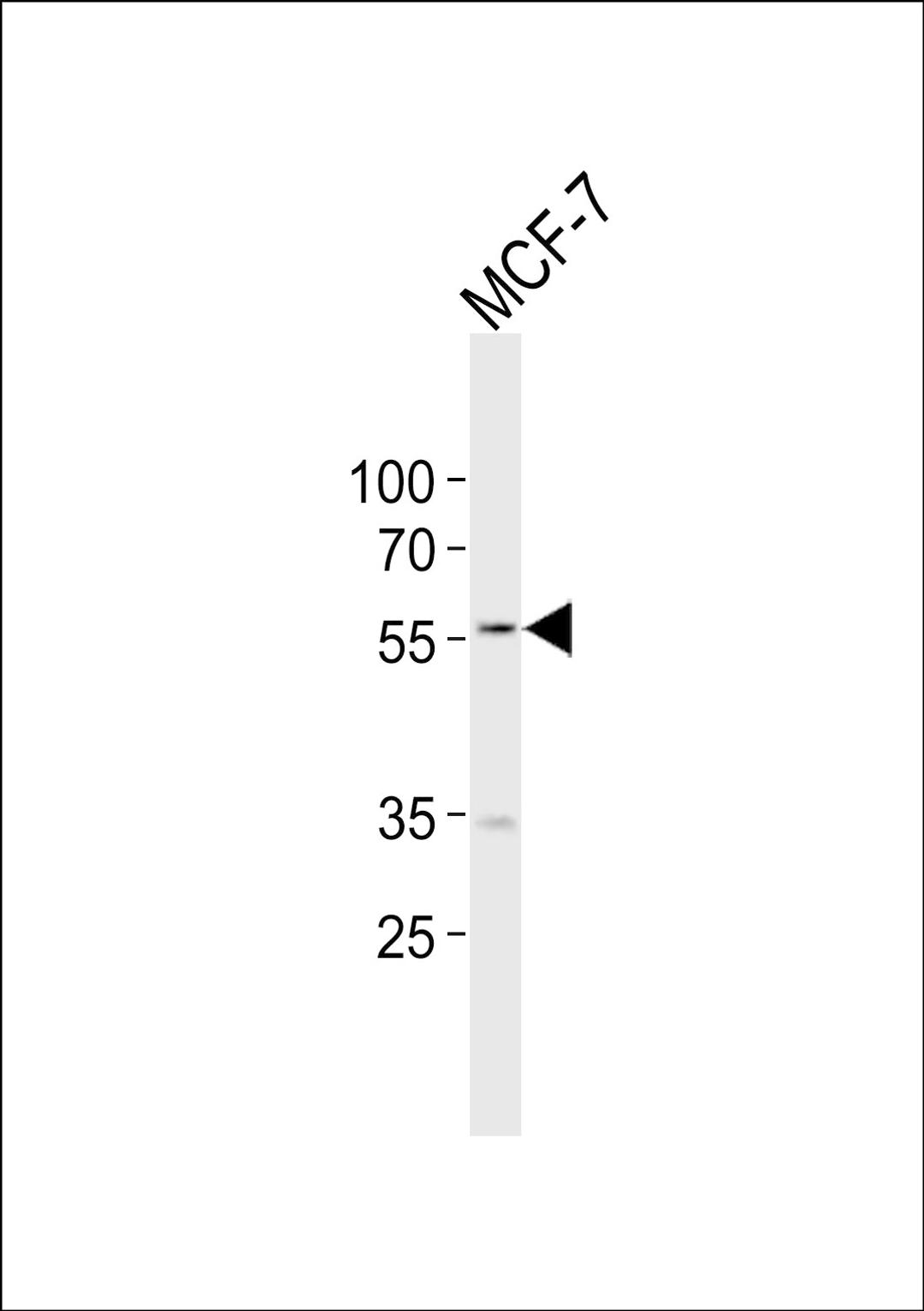 Western blot analysis of lysate from MCF-7 cell line, using NAMPT Antibody at 1:1000.