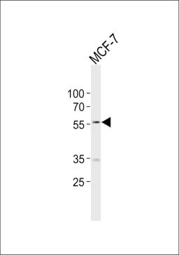 Western blot analysis of lysate from MCF-7 cell line, using NAMPT Antibody at 1:1000.