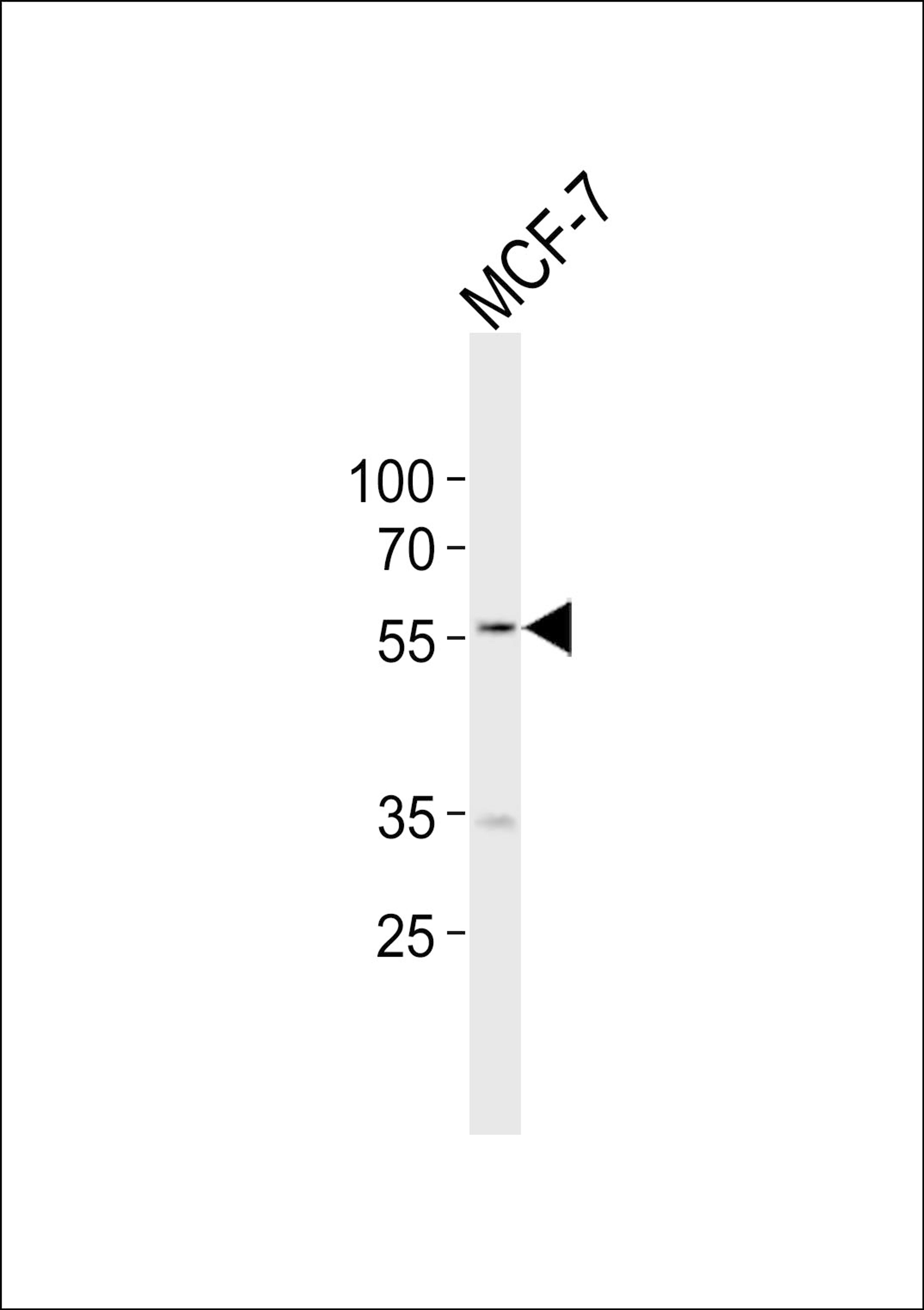 Western blot analysis of lysate from MCF-7 cell line, using NAMPT Antibody at 1:1000.