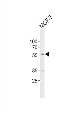 Western blot analysis of lysate from MCF-7 cell line, using NAMPT Antibody at 1:1000.
