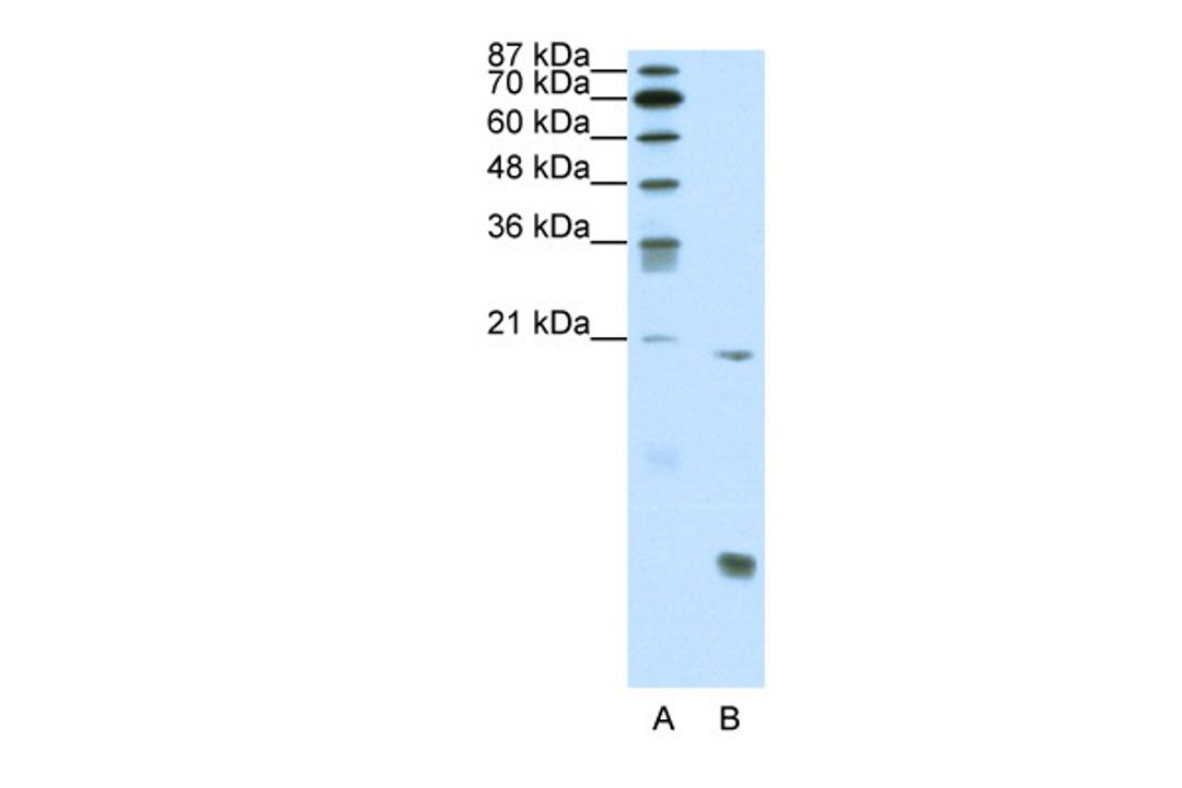 Antibody used in WB on Human Jurkat cells at 0.2-1 ug/ml.