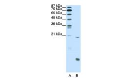 Antibody used in WB on Human Jurkat cells at 0.2-1 ug/ml.