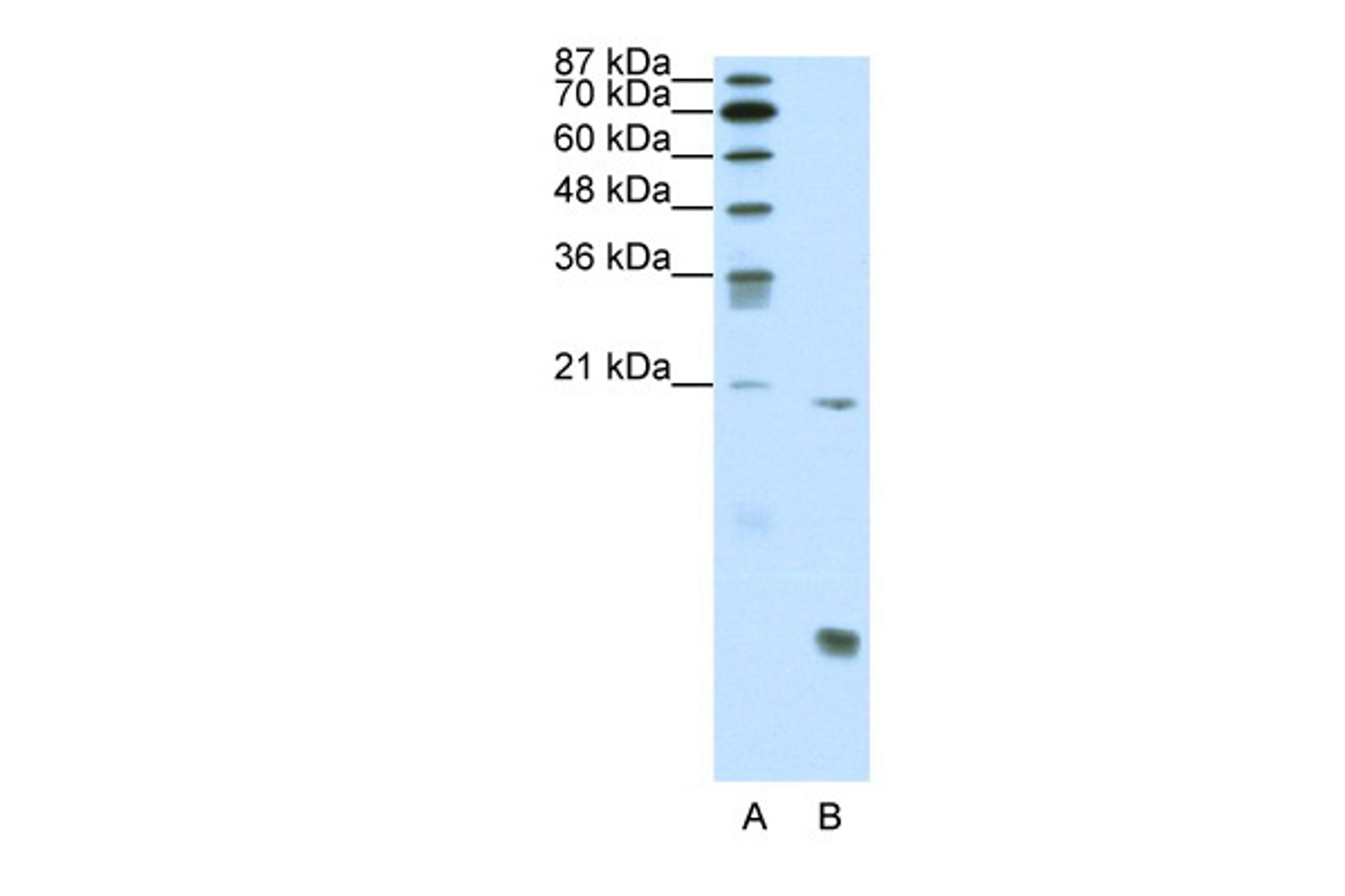 Antibody used in WB on Human Jurkat cells at 0.2-1 ug/ml.