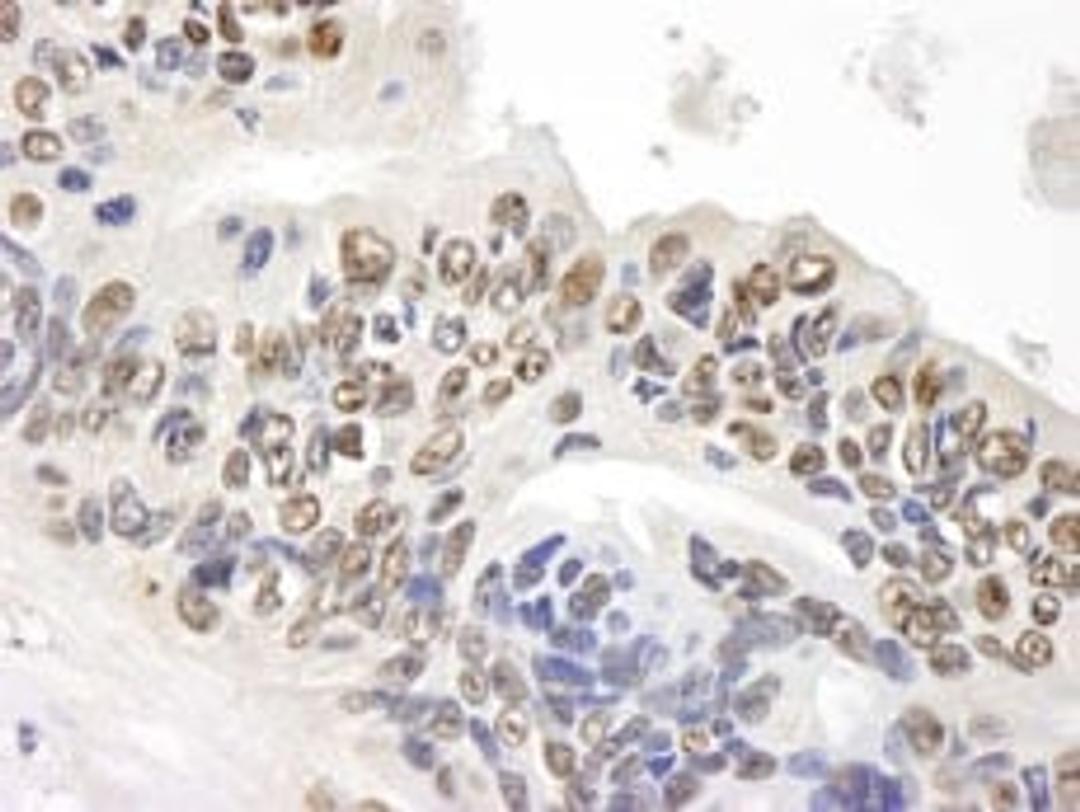 Detection of human GAPDH by immunohistochemistry.