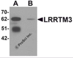 Western blot analysis of LRRTM3 in mouse brain tissue lysate with LRRTM3 antibody at 0.5 &#956;g/mL in (A) the absence and (B) the presence of blocking peptide.