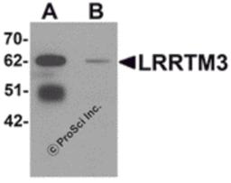 Western blot analysis of LRRTM3 in mouse brain tissue lysate with LRRTM3 antibody at 0.5 μg/mL in (A) the absence and (B) the presence of blocking peptide.